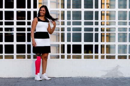 Press kit | 2467-01 - Press release | Confetti Prosthetic Leg Cover - Furf Design Studio - Product - ‘I discovered that what could be a flaw made me even more beautiful’, &nbsp;expresses Anne Caroline. - Photo credit: Furf Design Studio